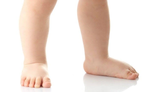 Childrens Podiatrist - Flat Feet Childrens Podiatrist - Flat Feet