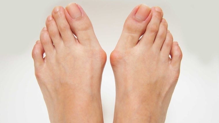 How to Treat Your Bulging Big Toe — Affiliated Foot & Ankle Center