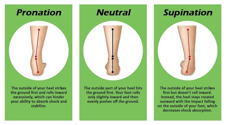 Orthotics for Common Foot Ailments - Pronation & Supination